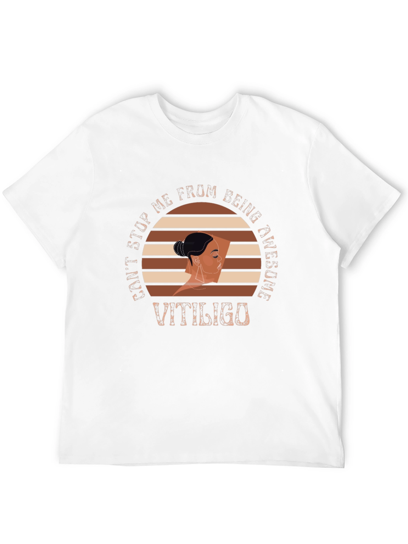Vitiligo Awesome Graphic T-Shirt