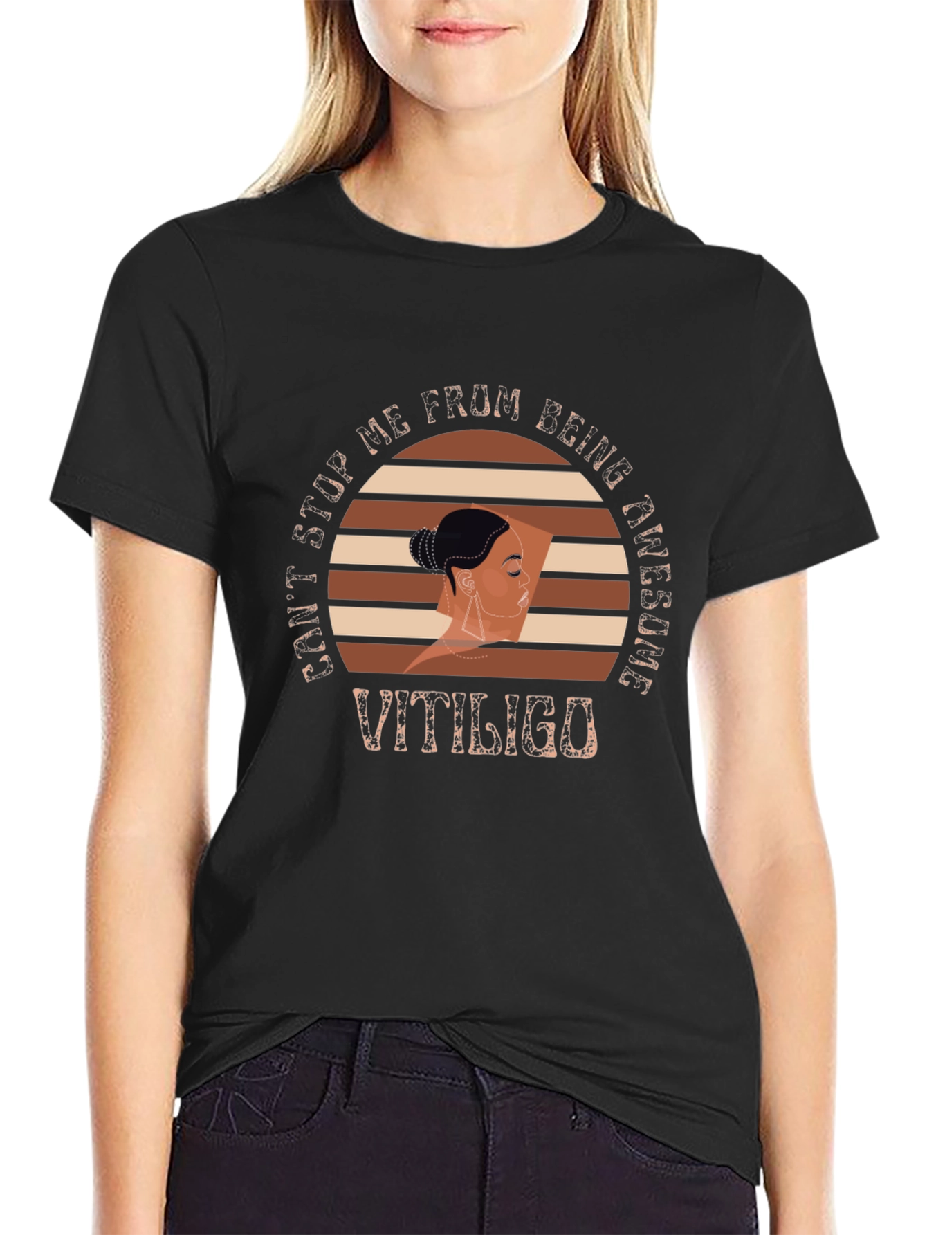 Vitiligo Awesome Graphic T-Shirt