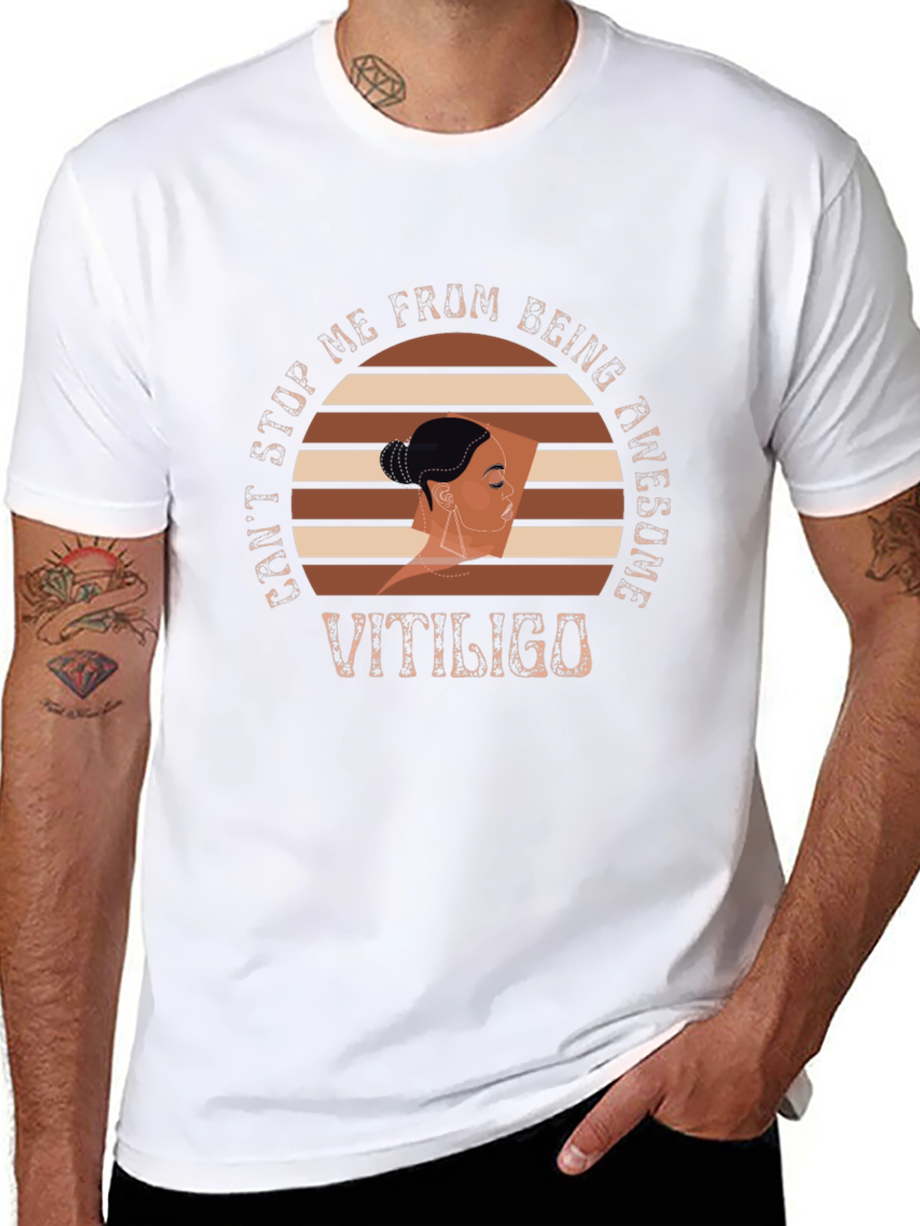 Vitiligo Awesome Graphic T-Shirt
