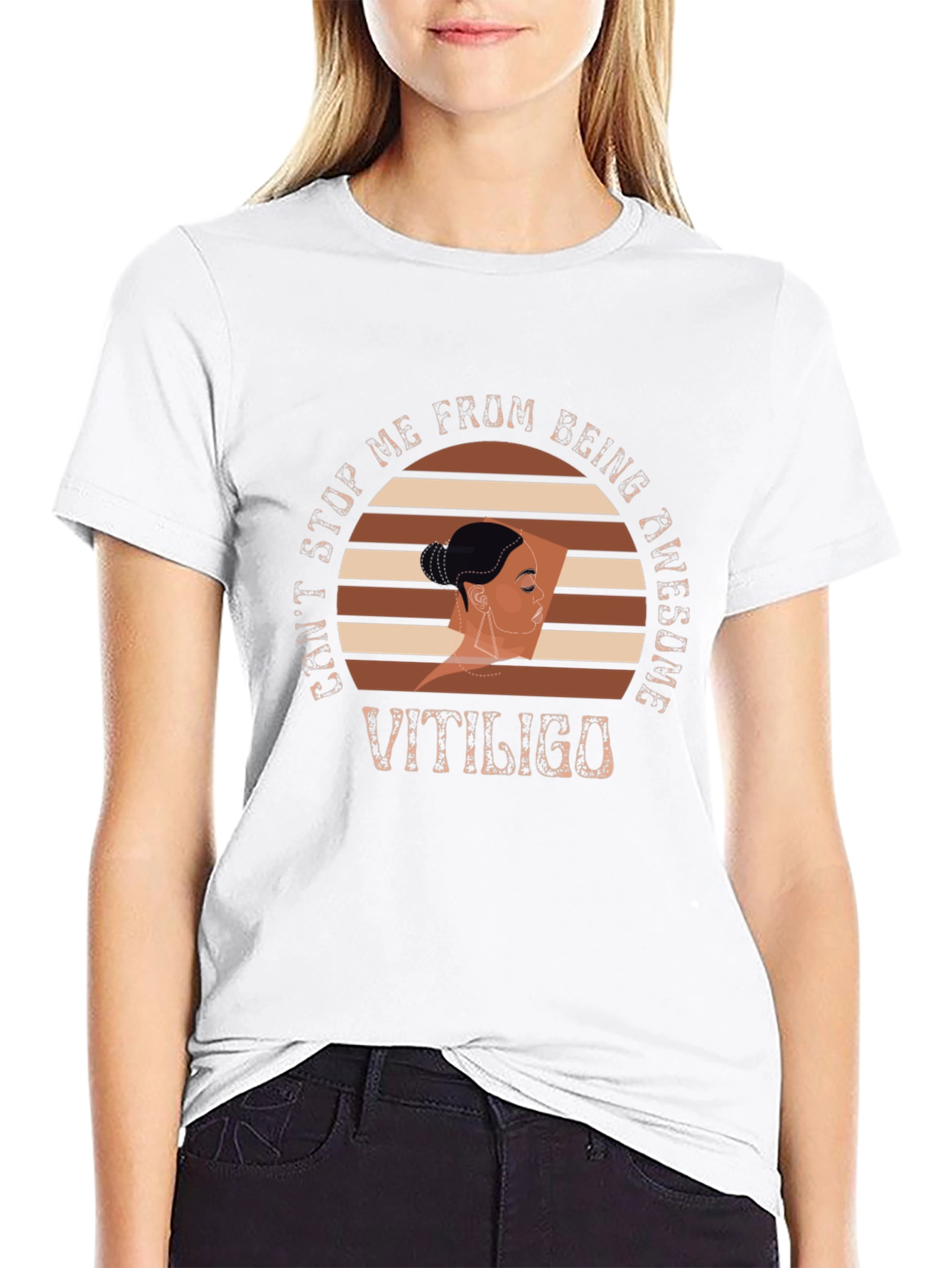 Vitiligo Awesome Graphic T-Shirt