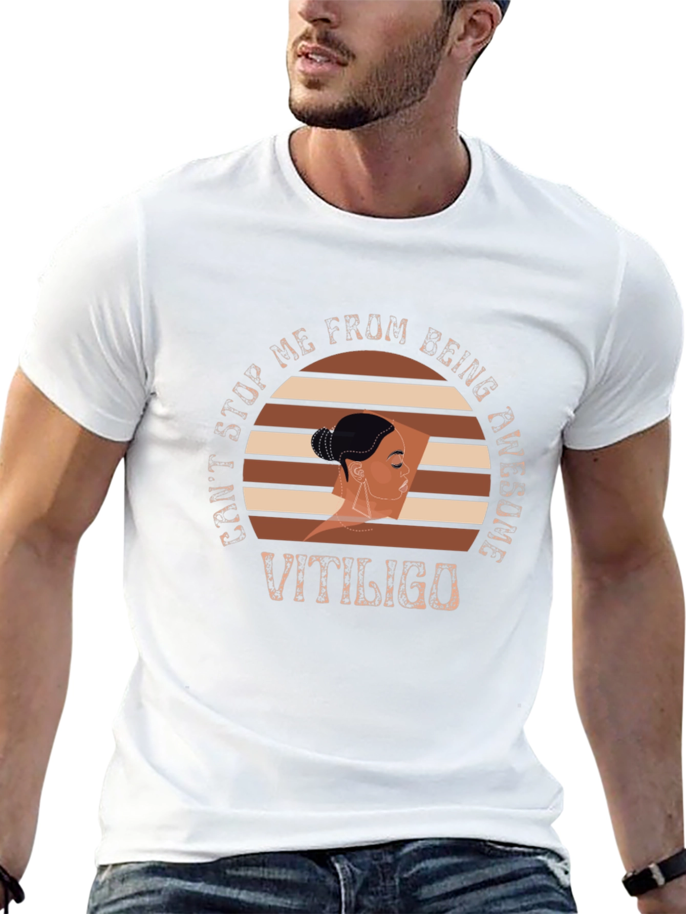 Vitiligo Awesome Graphic T-Shirt