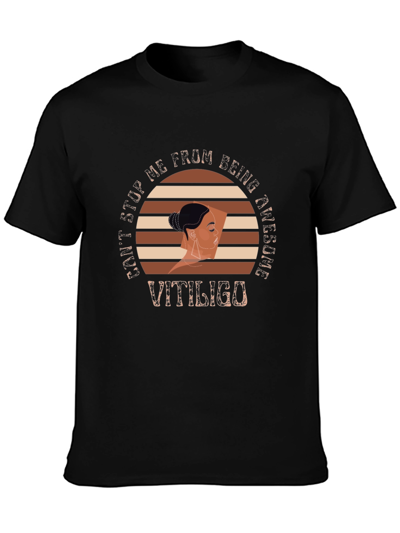 Vitiligo Awesome Graphic T-Shirt
