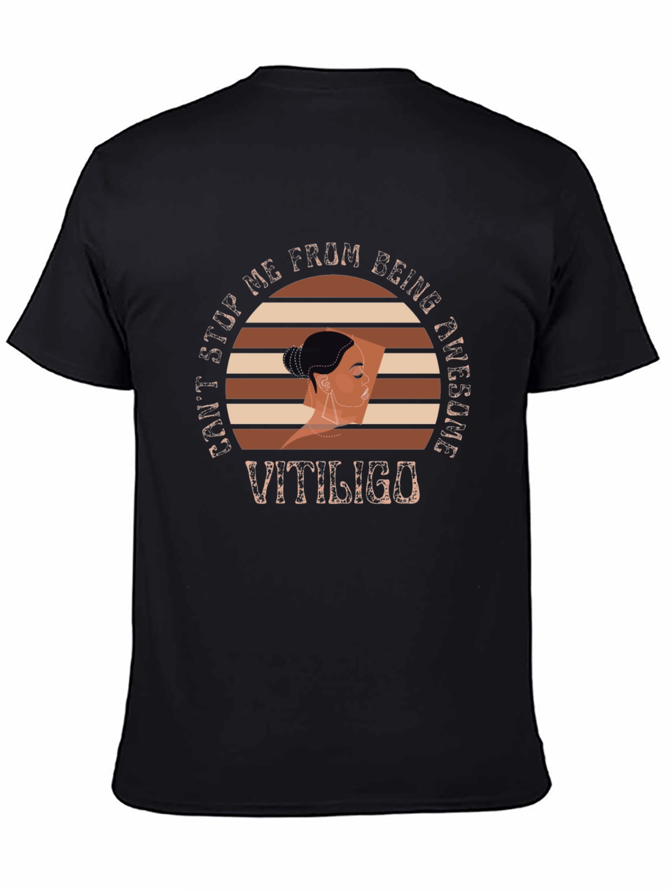 Vitiligo Awesome Graphic T-Shirt